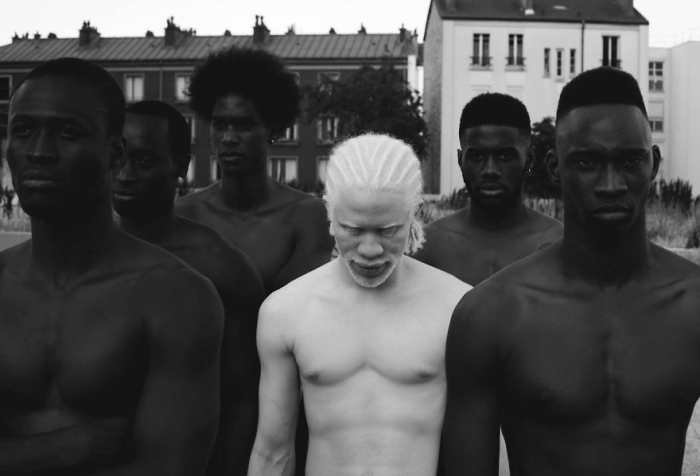 albinism-beautiful-albino-people-15