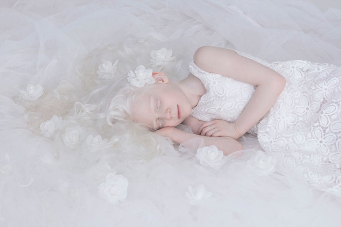 albinism-beautiful-albino-people-14
