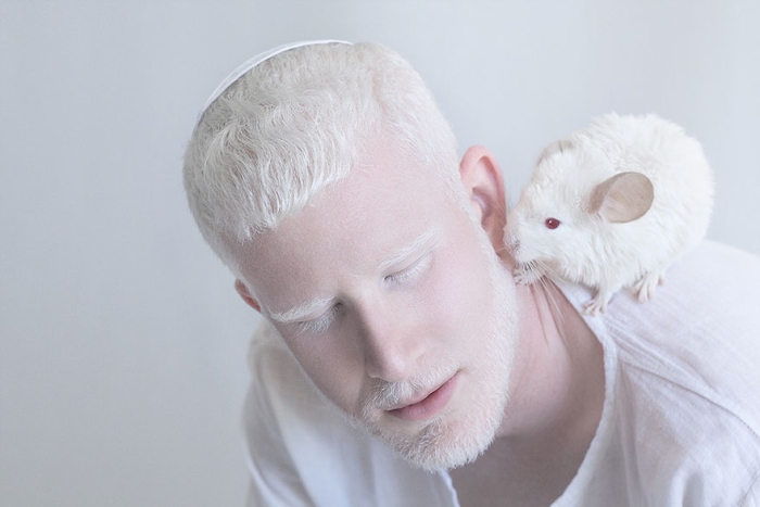 albinism-beautiful-albino-people-3