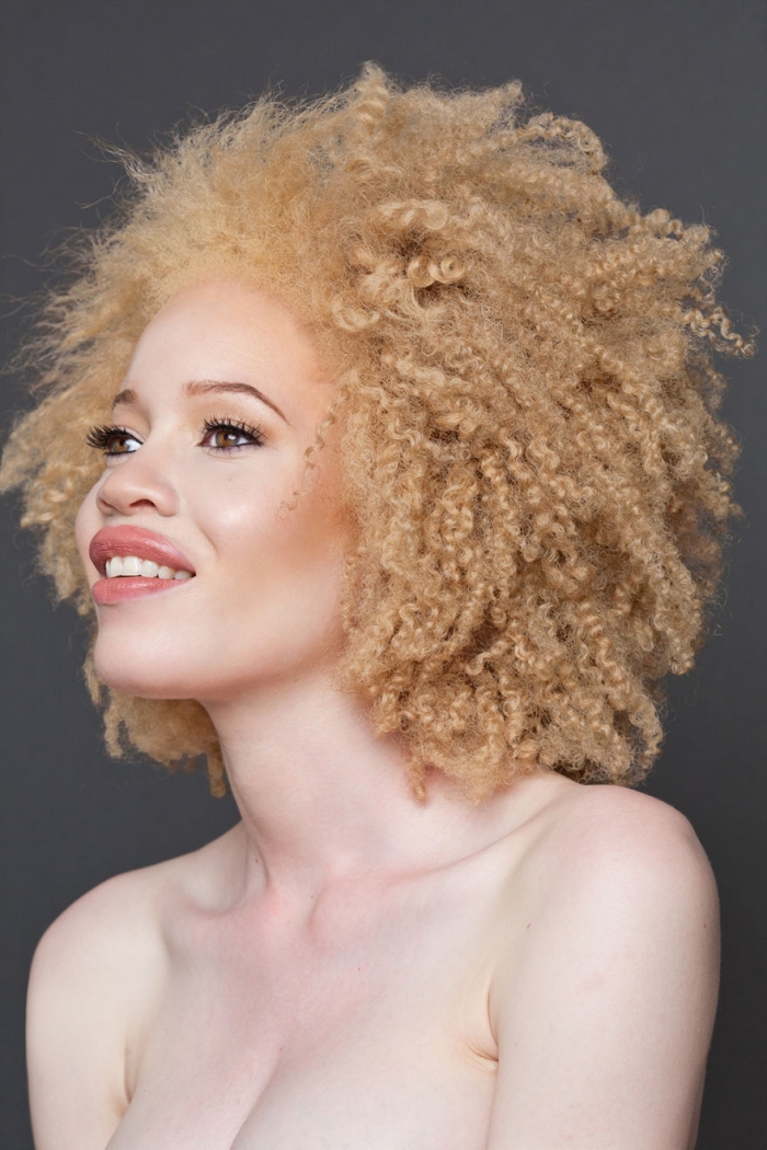 albinism-beautiful-albino-people-6