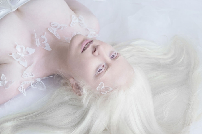 albinism-beautiful-albino-people-2