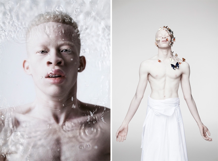 albinism-beautiful-albino-people-5