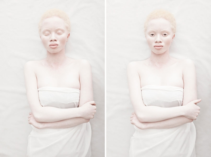albinism-beautiful-albino-people-1