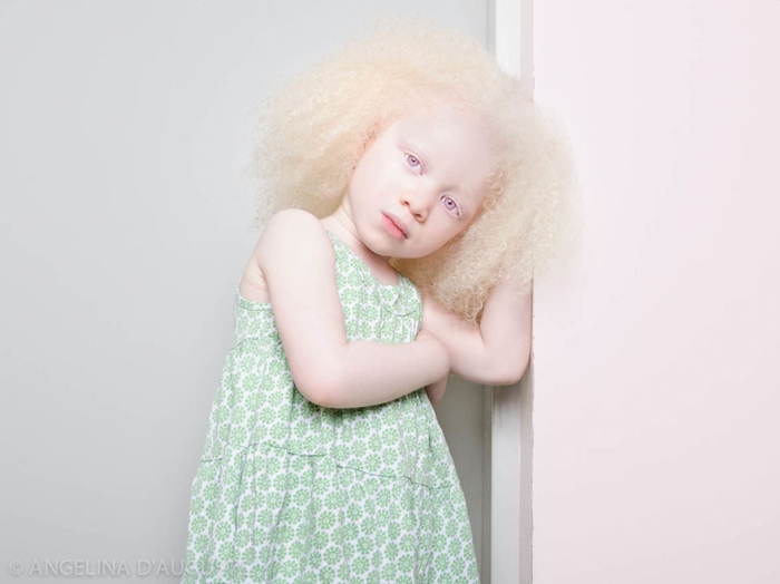 albinism-beautiful-albino-people-10