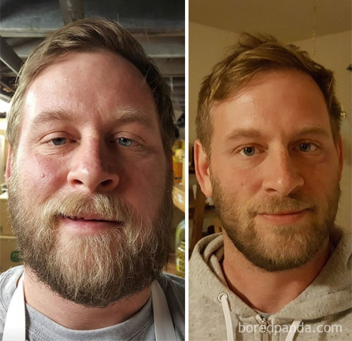 before-after-sobriety-photos-alcoholism-6
