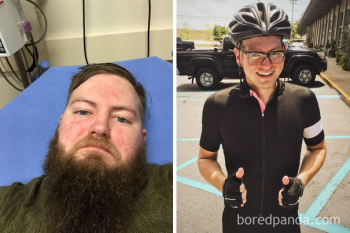 before-after-sobriety-photos-alcoholism-8