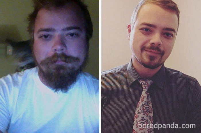 before-after-sobriety-photos-alcoholism-1