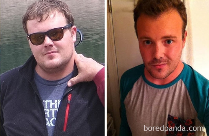 before-after-sobriety-photos-alcoholism-5
