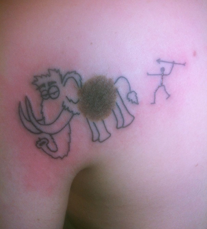 creative-tattoos-birthmark-cover-ups-3