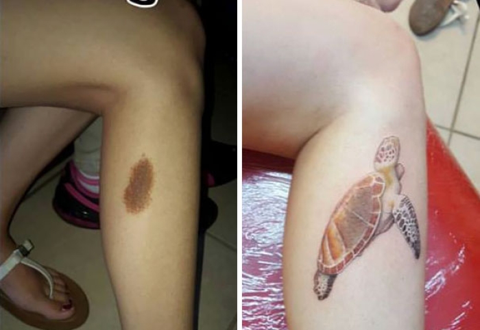 creative-tattoos-birthmark-cover-ups-10