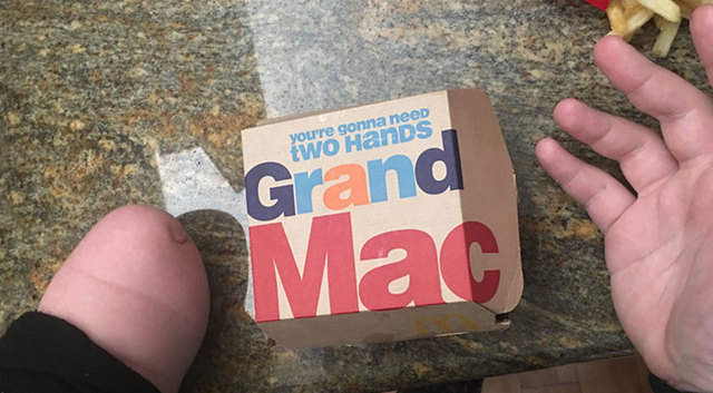 10+ Hilarious Amputees Who Made The Best Jokes Out Of Their Situation